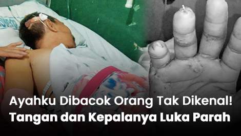 Ayahku Dibacok Orang Tak Dikenal! Tangan dan Kepalanya Luka Parah