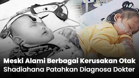 Ajaib! Meski Alami Berbagai Kerusakan Otak, Shadiahana Patahkan Diagnosa Dokter
