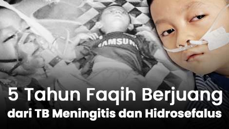 Pantang Menyerah! 5 Tahun Faqih Berjuang dari TB Meningitis dan Hidrosefalus