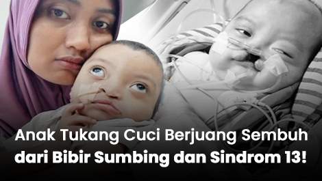 Anak Tukang Cuci Berjuang Sembuh dari Bibir Sumbing dan Sindrom 13!