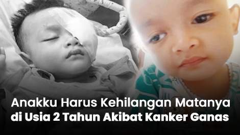 Tuhan, Anakku Harus Kehilangan Matanya di Usia 2 Tahun Akibat Kanker Ganas