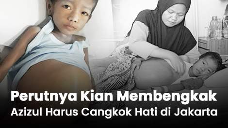 Perutnya Kian Membengkak, Azizul Harus Cangkok Hati di Jakarta