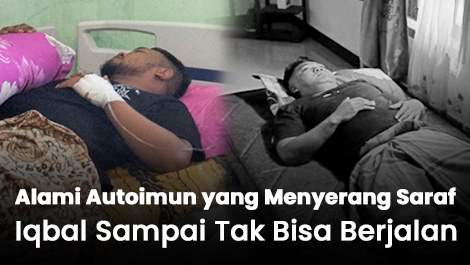 Alami Autoimun yang Menyerang Saraf, Iqbal Sampai Tak Bisa Berjalan