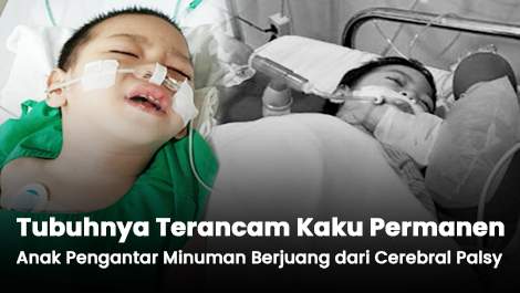 Tubuhnya Terancam Kaku Permanen, Anak Pengantar Minuman Berjuang dari Cerebral Palsy