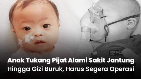 Anak Tukang Pijat Alami Sakit Jantung Hingga Gizi Buruk, Harus Segera Operasi