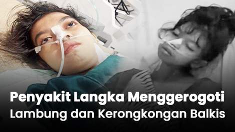 Penyakit Langka Menggerogoti Lambung dan Kerongkongan Balkis