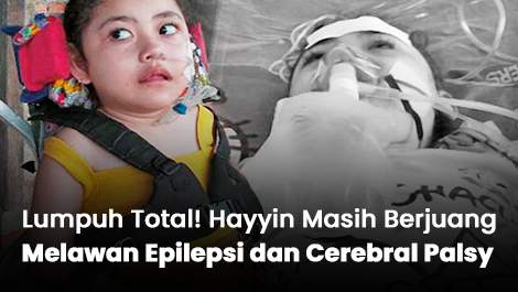Lumpuh Total! Hayyin Masih Berjuang Melawan Epilepsi dan Cerebral Palsy
