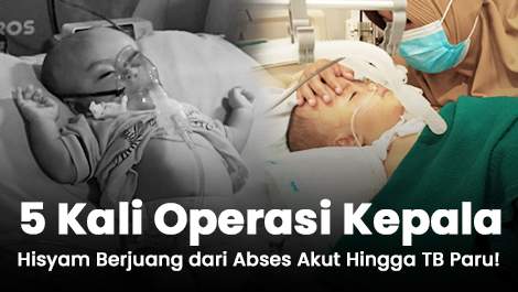 5 Kali Operasi Kepala, Hisyam Berjuang dari Abses Akut Hingga TB Paru!