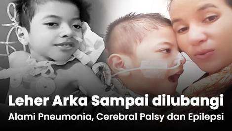 Lehernya Sampai dilubangi, Arka Alami Pneumonia, Cerebral Palsy dan Epilepsi