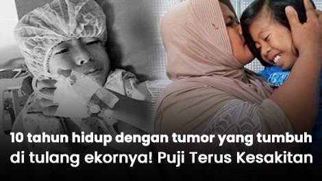 10 tahun hidup dengan tumor yang tumbuh di tulang ekornya! Puji Terus Kesakitan