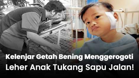 Kelenjar Getah Bening Menggerogoti Leher Anak Tukang Sapu Jalan!