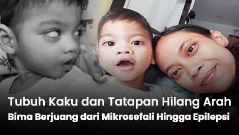 Tubuh Kaku dan Tatapan Hilang Arah, Bima Berjuang dari Mikrosefali Hingga Epilepsi