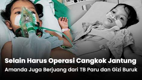 Selain Harus Operasi Cangkok Jantung, Amanda Juga Berjuang dari TB Paru dan Gizi Buruk