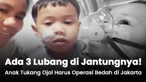 Ada 3 Lubang di Jantungnya! Anak Tukang Ojol Harus Operasi Bedah di Jakarta