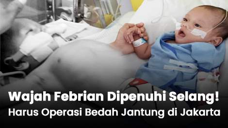 Wajahnya Dipenuhi Selang! Febrian Harus Operasi Bedah Jantung di Jakarta