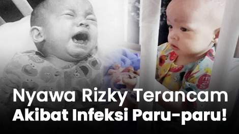 Nyawa Rizky Terancam Akibat Infeksi Paru-paru!