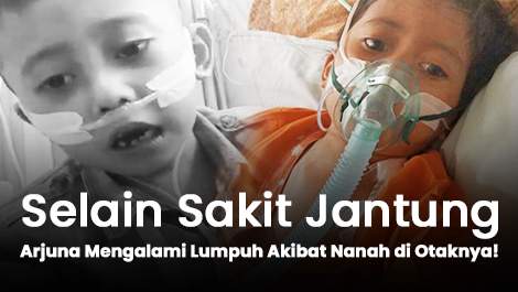 Selain Sakit Jantung, Arjuna Juga Mengalami Lumpuh Akibat Ada Nanah di Otaknya!