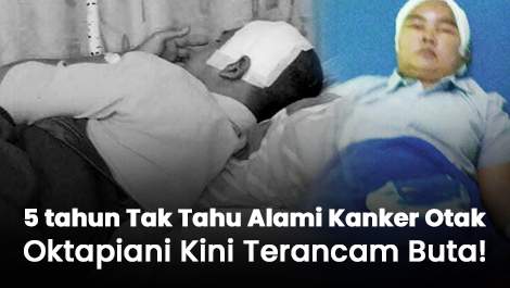 5 tahun Tak Tahu Alami Kanker Otak, Oktapiani Kini Terancam Buta!