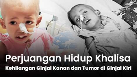 Perjuangan Hidup Khalisa yang Kehilangan Ginjal Kanan dan Tumor di Ginjal Kiri