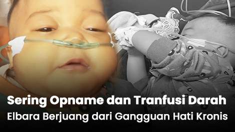 Sering Opname dan Tranfusi Darah, Elbara Berjuang dari Gangguan Hati Kronis