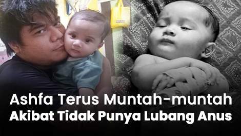 Ashfa Terus Muntah-muntah Akibat Tidak Punya Lubang Anus