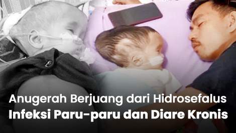 Jeritannya Menyayat Hati, Anugerah Berjuang dari Hidrosefalus, Infeksi Paru-paru dan Diare Kronis
