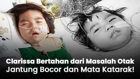 Clarissa Bertahan dari Masalah Otak, Jantung Bocor dan Mata Katarak!
