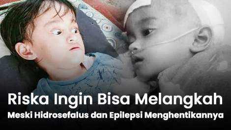 Riska Ingin Bisa Melangkah, Meski Hidrosefalus dan Epilepsi Menghentikannya