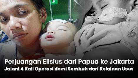 Perjuangan dari Papua ke Jakarta, Elisius Jalani 4 Kali Operasi demi Sembuh dari Kelainan Usus