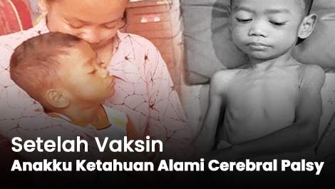 Setelah Vaksin, Anakku Ketahuan Alami Cerebral Palsy