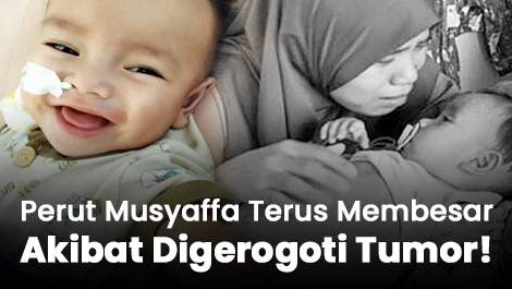 Perut Musyaffa Terus Membesar Akibat Digerogoti Tumor!