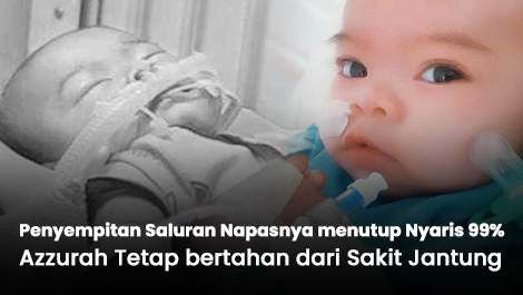 Penyempitan Saluran Napasnya menutup Nyaris 99%, Azzurah Tetap bertahan dari Sakit Jantung