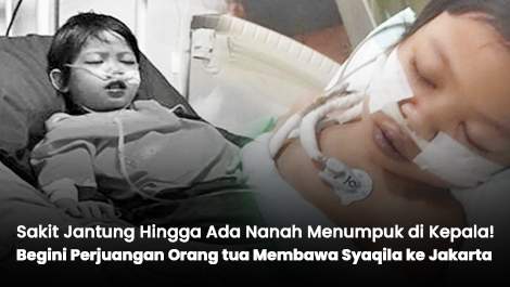 Sakit Jantung Hingga Ada Nanah Menumpuk di Kepala! Begini Perjuangan Orang tua Membawa Syaqila ke Jakarta