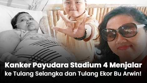 Kanker Payudara Stadium 4 Menjalar ke Tulang Selangka dan Tulang Ekor Bu Arwin!