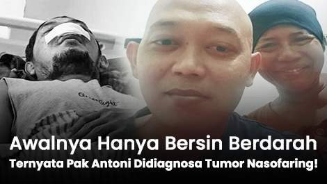 Awalnya Hanya Bersin Berdarah, Ternyata Pak Antoni Didiagnosa Tumor Nasofaring!