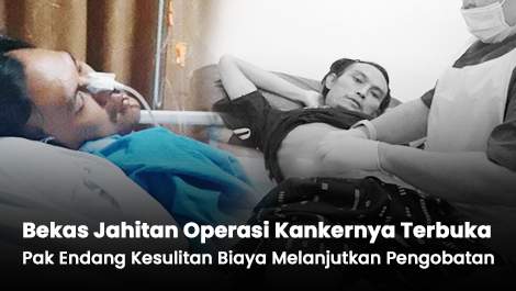 Bekas Jahitan Operasi Kankernya Terbuka, Pak Endang Kesulitan Biaya Melanjutkan Pengobatan