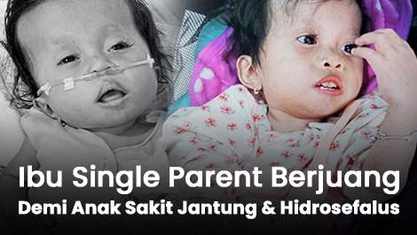 Ibu Single Parent Berjuang untuk Anaknya yang Sakit Jantung Hingga Hidrosefalus