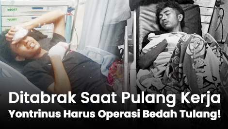 Ditabrak Saat Pulang Kerja, Yontrinus Harus Operasi Bedah Tulang!