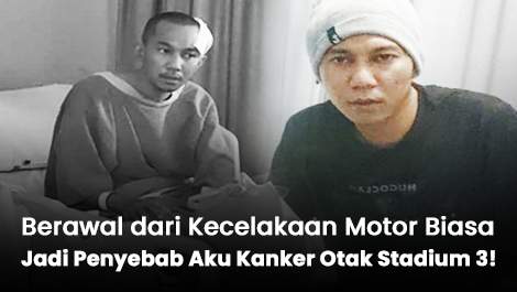 Berawal dari Kecelakaan Motor Biasa, Ternyata Jadi Penyebab Aku Kanker Otak Stadium 3!