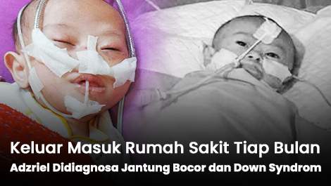 Keluar Masuk Rumah Sakit Tiap Bulan, Adzriel Didiagnosa Jantung Bocor dan Down Syndrom