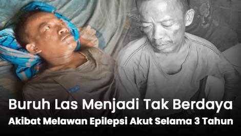 Buruh Las Menjadi Tak Berdaya Akibat Melawan Epilepsi Akut Selama 3 Tahun