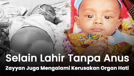 Selain Lahir Tanpa Anus, Zayyan Juga Mengalami Kerusakan Organ Hati