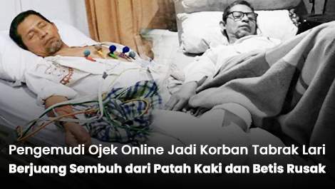 Jadi Korban Tabrak Lari, Pengemudi Ojek Online Berjuang Sembuh dari Patah Kaki dan Betis Rusak