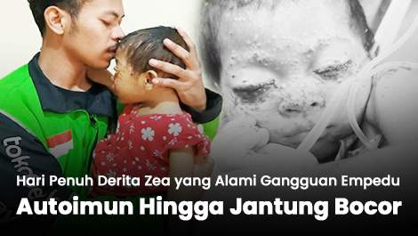 Hari Penuh Derita Zea yang Alami Gangguan Empedu, Autoimun Hingga Jantung Bocor