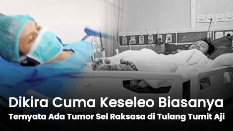 Dikira Cuma Keseleo Biasanya, Ternyata Ada Tumor Sel Raksasa di TUlang Tumit Aji
