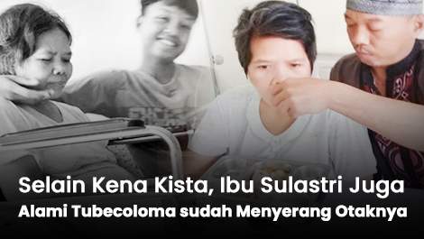 Selain Kena Kista, Ibu Sulastri Juga Alami Tubecoloma yang sudah Menyerang Otaknya