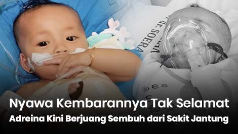 Nyawa Kembarannya Tak Selamat, Adreina Kini Berjuang Sembuh dari Sakit Jantung