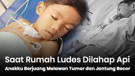 Saat Rumah Ludes Dilahap Api, Anakku Masih Berjuang Melawan Tumor dan Jantung Bocor