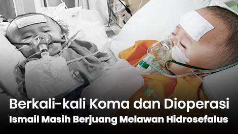 Berkali-kali Koma dan Dioperasi, Ismail Masih Berjuang Melawan Hidrosefalus