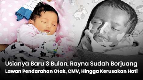 Usianya Baru 3 Bulan, Rayna Sudah Berjuang Lawan Pendarahan Otak, CMV, Hingga Kerusakan Hati